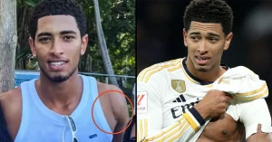 ჯუდ ბელინგემმა ოპერაცია გაიკეთა - დიდი იარა ინგლისელის მხარზე