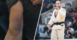 ლაშა ბექაურის ტრავმის სიმძიმე ცნობილია | 2-გზის ოლიმპიურ ჩემპიონს ბიცეფსის კუნთი აქვს გაწყვეტილი